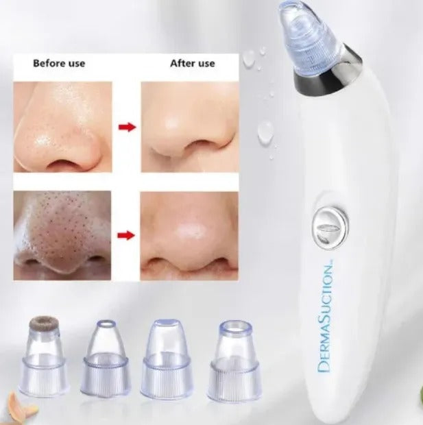 Derma Suction Pore Cleaning Device