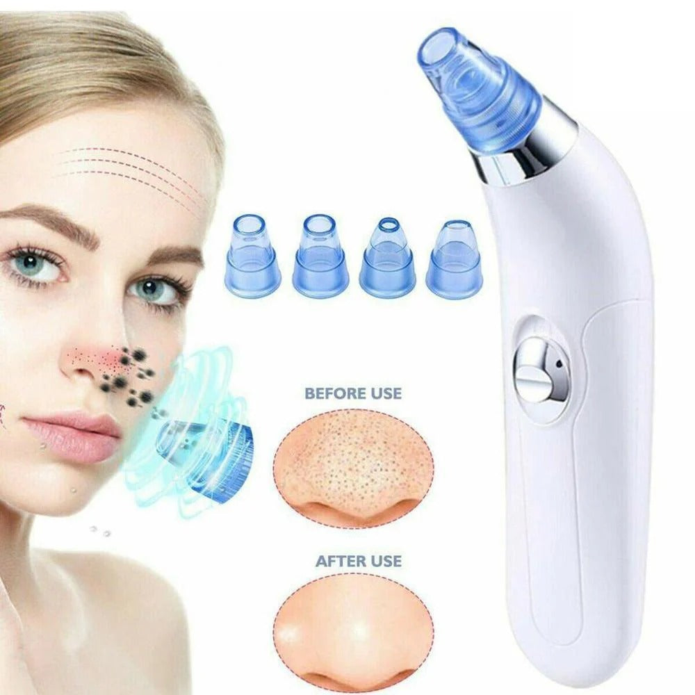 Derma Suction Pore Cleaning Device