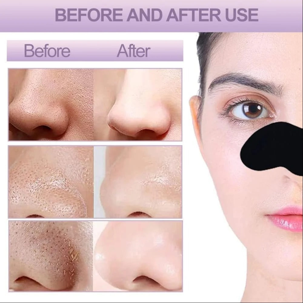 20 Pcs BLACKHEAD REMOVER STRIPS